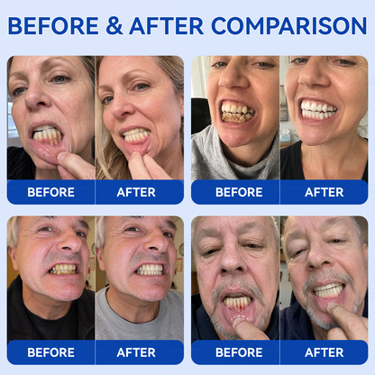 🇬🇧Glimmerly® 🦷GumRevive periodontal repair gel🔥