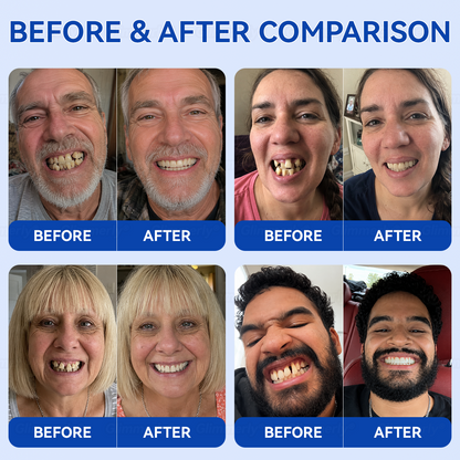 🇬🇧Glimmerly® 🦷GumRevive periodontal repair gel🔥