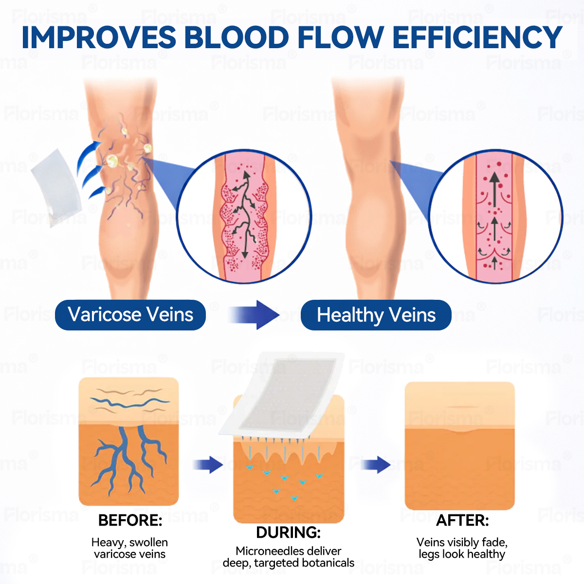 One Patch a Day. Visible Vein Relief in Just 7 Days 👨‍⚕️ 𝑭𝑳𝑶𝑹𝑰𝑺𝑴𝑨® 𝑫𝑰𝑶𝑺𝑴𝑰𝑵 & 𝑯𝑬𝑺𝑷𝑬𝑹𝑰𝑫𝑰𝑵 𝑪𝒍𝒊𝒏𝒊𝒄𝒂𝒍-𝑮𝒓𝒂𝒅𝒆 𝑭𝒐𝒓𝒎𝒖𝒍𝒂 𝑴𝒊𝒄𝒓𝒐𝒏𝒆𝒆𝒅𝒍𝒆 𝑷𝒂𝒕𝒄𝒉  🌳 𝗔𝗱𝘃𝗮𝗻𝗰𝗲𝗱 𝗛𝗲𝗿𝗯𝗮𝗹 𝗕𝗹𝗲𝗻𝗱 𝗧𝗮𝗿𝗴𝗲𝘁𝘀 𝗦𝗽𝗶𝗱𝗲𝗿 𝗩𝗲𝗶𝗻𝘀 & 𝗥𝗲𝗹𝗶𝗲𝘃𝗲𝘀 𝗛𝗲𝗮𝘃𝘆, 𝗧𝗶𝗿𝗲𝗱 𝗟𝗲𝗴𝘀美国别复制