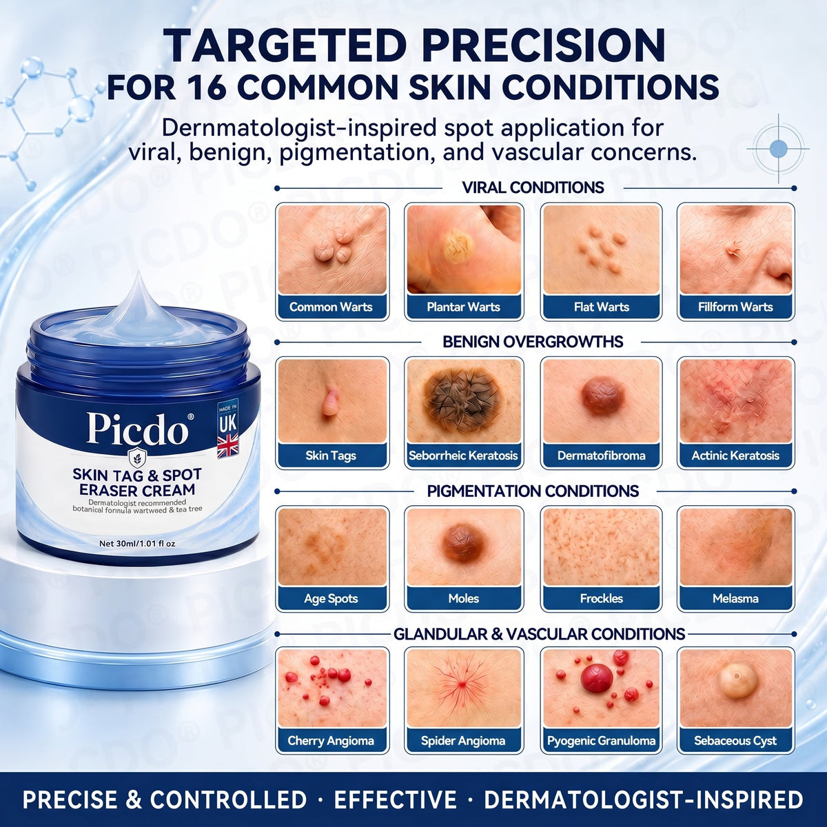 𝐏𝐢𝐜𝐝𝐨®🥇7-𝐃𝐚𝐲 𝐒𝐤𝐢𝐧 𝐓𝐚𝐠 & 𝐒𝐩𝐨𝐭 𝐄𝐫𝐚𝐬𝐞𝐫 𝐂𝐫𝐞𝐚𝐦(Zero Pain, Zero 𝐒𝐜𝐚𝐫𝐬 Formula)💎