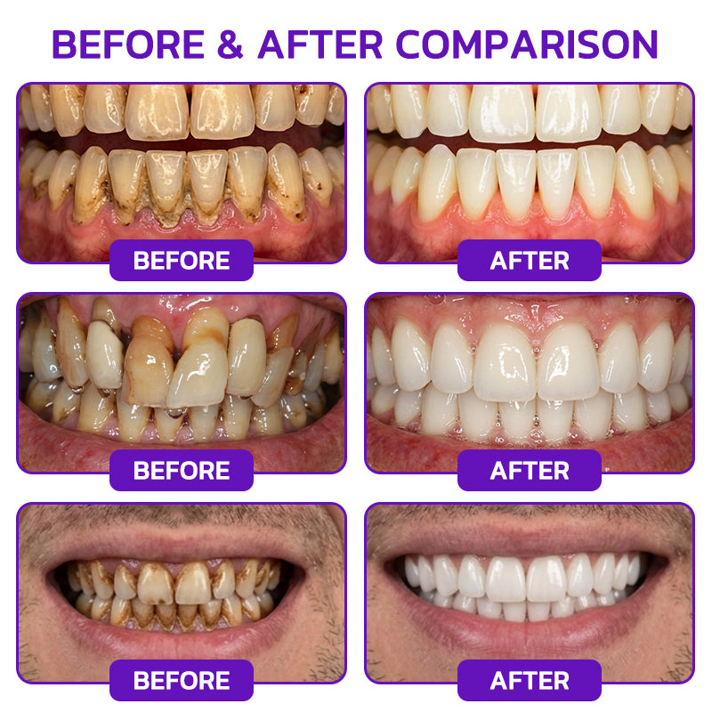 Glimmerly®🦷 VioCore Bee Venom Gingivitis & Periodontitis Treatment Toothpaste❄️