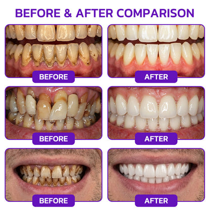 Glimmerly®🦷 VioCore Bee Venom Gingivitis & Periodontitis Treatment Toothpaste❄️