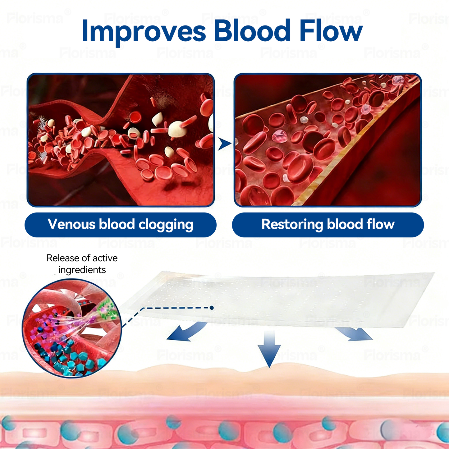One Patch a Day. Visible Vein Relief in Just 7 Days 👨‍⚕️ 𝑭𝑳𝑶𝑹𝑰𝑺𝑴𝑨® 𝑫𝑰𝑶𝑺𝑴𝑰𝑵 & 𝑯𝑬𝑺𝑷𝑬𝑹𝑰𝑫𝑰𝑵 𝑪𝒍𝒊𝒏𝒊𝒄𝒂𝒍-𝑮𝒓𝒂𝒅𝒆 𝑭𝒐𝒓𝒎𝒖𝒍𝒂 𝑴𝒊𝒄𝒓𝒐𝒏𝒆𝒆𝒅𝒍𝒆 𝑷𝒂𝒕𝒄𝒉  🌳 𝗔𝗱𝘃𝗮𝗻𝗰𝗲𝗱 𝗛𝗲𝗿𝗯𝗮𝗹 𝗕𝗹𝗲𝗻𝗱 𝗧𝗮𝗿𝗴𝗲𝘁𝘀 𝗦𝗽𝗶𝗱𝗲𝗿 𝗩𝗲𝗶𝗻𝘀 & 𝗥𝗲𝗹𝗶𝗲𝘃𝗲𝘀 𝗛𝗲𝗮𝘃𝘆, 𝗧𝗶𝗿𝗲𝗱 𝗟𝗲𝗴𝘀美国别复制
