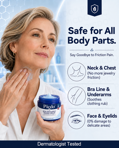𝐏𝐢𝐜𝐝𝐨®🥇7-𝐃𝐚𝐲 𝐒𝐤𝐢𝐧 𝐓𝐚𝐠 & 𝐒𝐩𝐨𝐭 𝐄𝐫𝐚𝐬𝐞𝐫 𝐂𝐫𝐞𝐚𝐦(Zero Pain, Zero 𝐒𝐜𝐚𝐫𝐬 Formula)💎