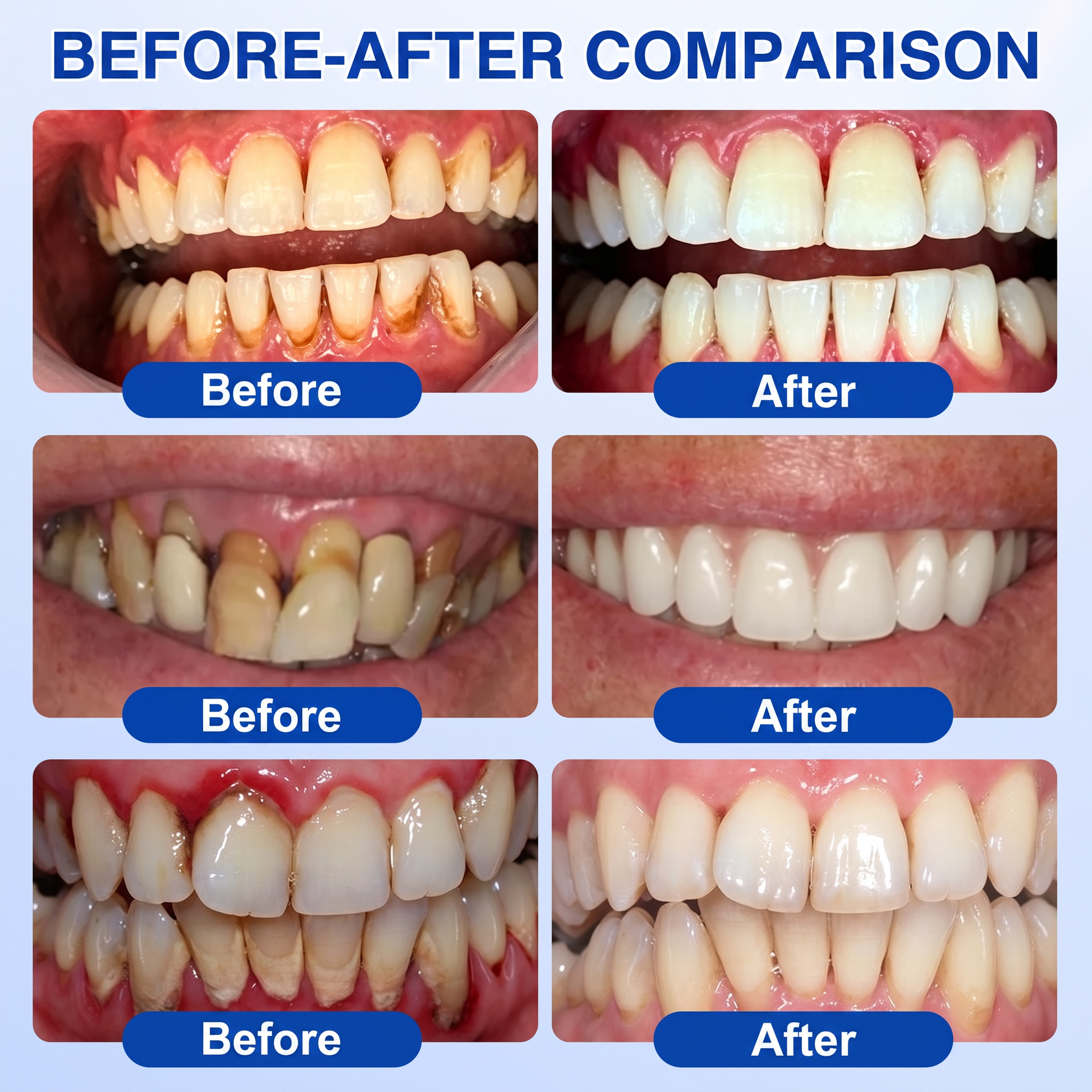 Additional before and after oral-care comparison examples