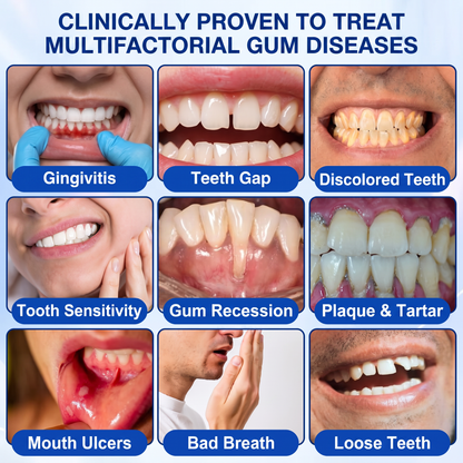 🇬🇧Glimmerly® 🦷GumRevive periodontal repair gel🍀