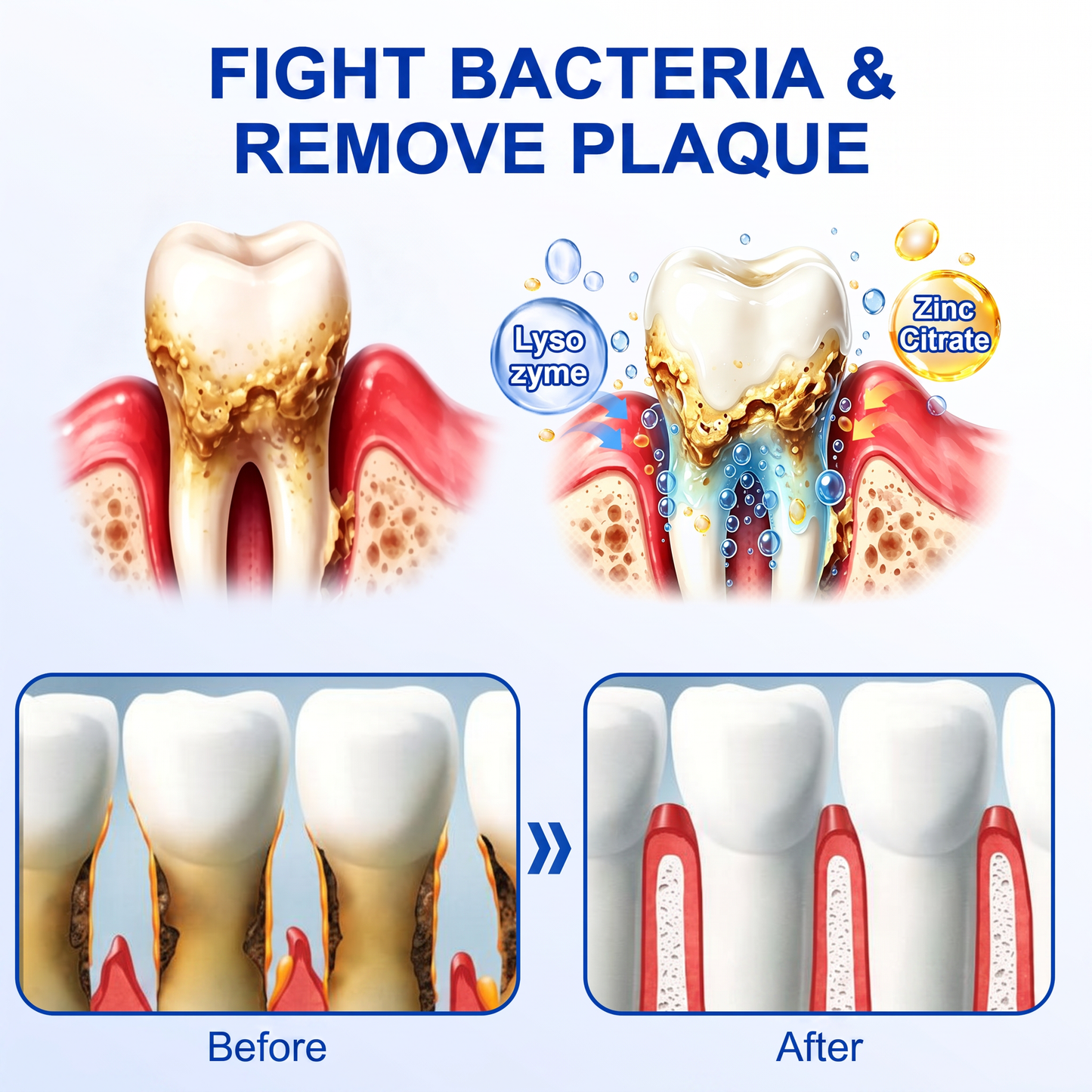 🇬🇧Glimmerly® 🦷GumRevive periodontal repair gel🍀
