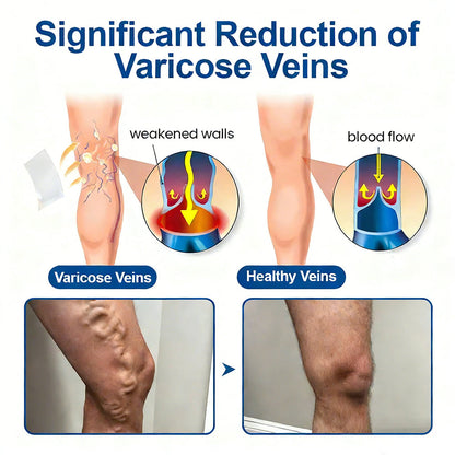 One Patch a Day. Visible Vein Relief in Just 7 Days 👨‍⚕️ Florisma® VeinTarget Microneedle Patch 🍀 Instant Relief, Long-Term Results
