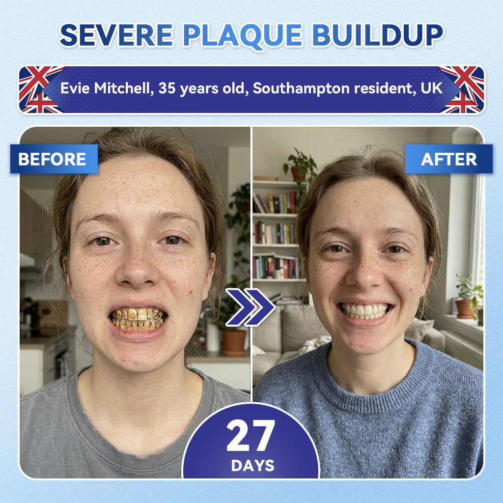 Glimmerly® 🦷 Tideglusib Fast‑Dissolving Tooth & Gum Repair Oral Strips 🔊 (Supports tooth repair and helps relieve gum discomfort and other common oral concerns)