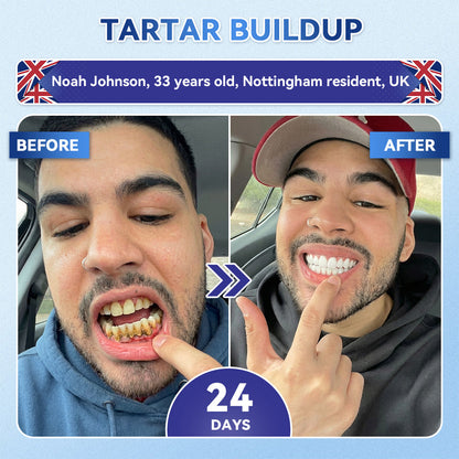 Glimmerly® 🦷 Tideglusib Fast‑Dissolving Tooth & Gum Repair Oral Strips 🔊 (Supports tooth repair and helps relieve gum discomfort and other common oral concerns)