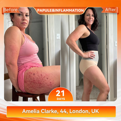 𝐎𝐟𝐟𝐢𝐜𝐢𝐚𝐥 𝐁𝐫𝐚𝐧𝐝 𝐒𝐭𝐨𝐫𝐞 🥇 𝐏𝐀𝐔𝐑𝐀𝐉𝐔® 𝟐𝟎𝟐𝟔 𝐌𝐨𝐫𝐢𝐧𝐠𝐚 & 𝐁𝐞𝐫𝐛𝐞𝐫𝐢𝐧𝐞 𝟒-𝐈𝐧-𝟏 𝐌𝐢𝐜𝐫𝐨-𝐏𝐚𝐫𝐭𝐢𝐜𝐥𝐞 𝐒𝐜𝐮𝐥𝐩𝐭𝐢𝐧𝐠 & 𝐅𝐚𝐭-𝐁𝐮𝐫𝐧 𝐒𝐡𝐨𝐫𝐭𝐬❄️