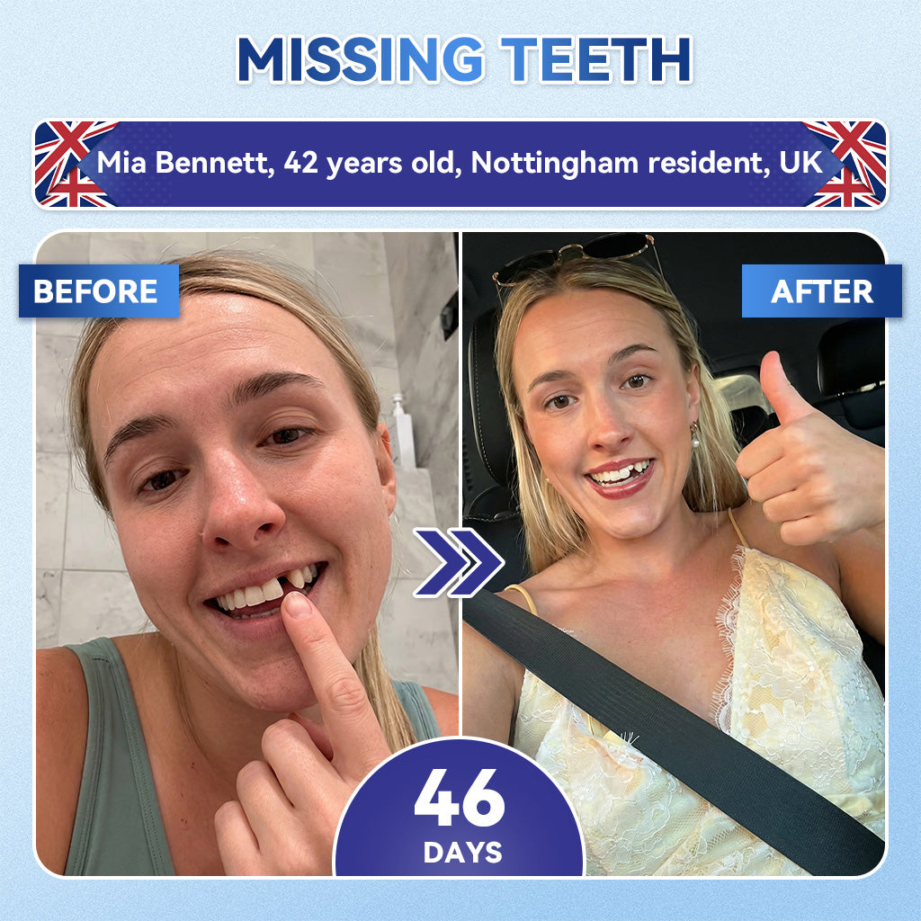 Glimmerly® 🦷 Tideglusib Fast‑Dissolving Tooth & Gum Repair Oral Strips 🔊 (Supports tooth repair and helps relieve gum discomfort and other common oral concerns)