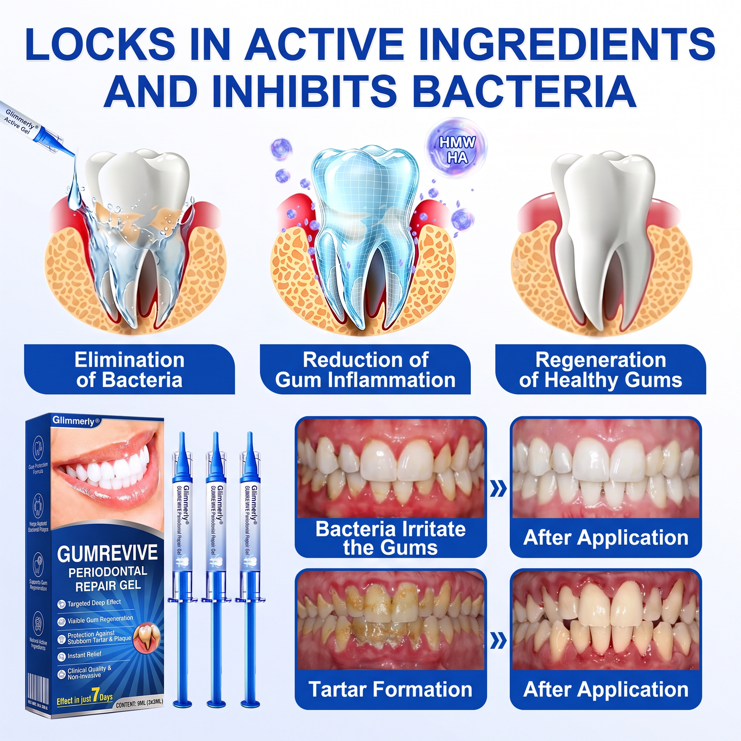 🇬🇧Glimmerly® 🦷GumRevive periodontal repair gel🍀