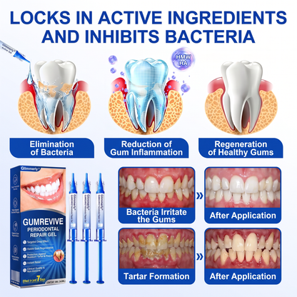 🇬🇧Glimmerly® 🦷GumRevive periodontal repair gel🍀