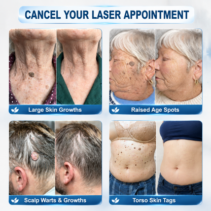 𝐎𝐟𝐟𝐢𝐜𝐢𝐚𝐥 𝐁𝐫𝐚𝐧𝐝 𝐒𝐭𝐨𝐫𝐞 🥇 𝐏i𝐜𝐝o® 7-𝐷𝑎𝑦 𝗧𝐚𝐠 & 𝗦𝗽𝐨𝐭 𝐄𝐫𝒂𝒔𝒆𝒓(Zero Pain, Zero 𝐒𝐜𝐚𝒓𝒔 Rollerball)🌈