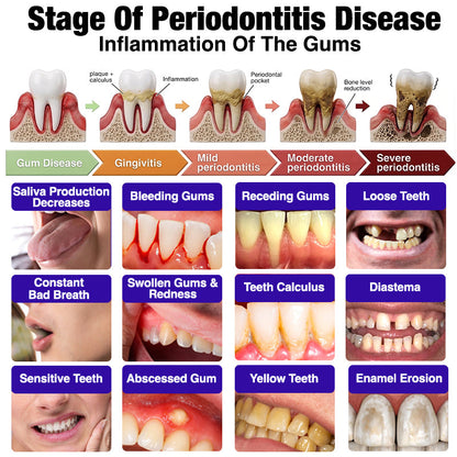 Glimmerly®🦷 VioCore Bee Venom Gingivitis & Periodontitis Treatment Toothpaste❄️